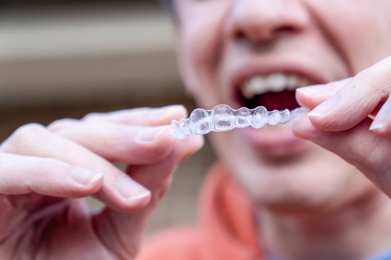 man-holds-put-on-invisible-braces-invisalign